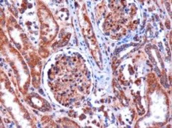 Anti-KIF5B antibody, C-term used in IHC (Paraffin sections) (IHC-P). GTX15705