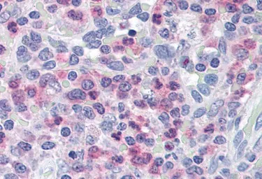 Anti-Munc 13-4 antibody, C-term used in IHC (Paraffin sections) (IHC-P). GTX15723
