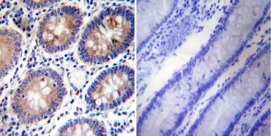Anti-PLK1 antibody [13E8] used in IHC (Paraffin sections) (IHC-P). GTX15779
