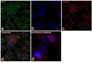 Anti-PLK1 antibody [13E8] used in Immunocytochemistry/ Immunofluorescence (ICC/IF). GTX15779