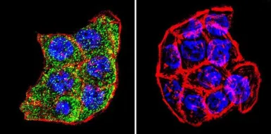 Anti-PLK1 antibody [13E8] used in Immunocytochemistry/ Immunofluorescence (ICC/IF). GTX15779