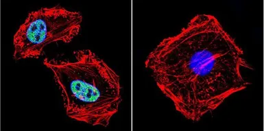 Anti-RPA32 antibody [MA34] used in Immunocytochemistry/ Immunofluorescence (ICC/IF). GTX15783