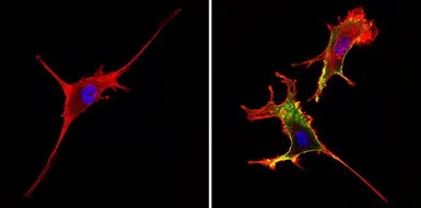 Anti-CD44 antibody [1M7.8.1] used in Immunocytochemistry/ Immunofluorescence (ICC/IF). GTX15834