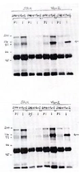 Anti-VAV2 antibody used in Western Blot (WB). GTX16135