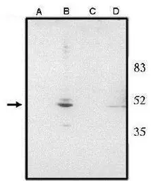 Anti-CHX10 antibody used in Western Blot (WB). GTX16142