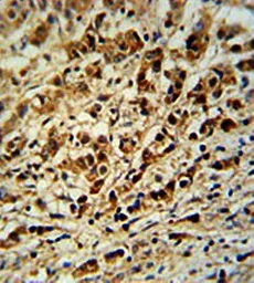 Anti-AVL9 antibody used in IHC (Paraffin sections) (IHC-P). GTX16209