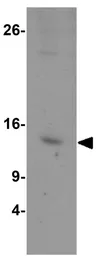 Anti-HIG2 antibody used in Western Blot (WB). GTX16280