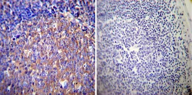 Anti-Glucocorticoid Receptor alpha antibody used in IHC (Paraffin sections) (IHC-P). GTX16318
