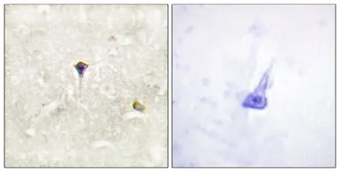 Anti-ALK (phospho Tyr1604) antibody used in IHC (Paraffin sections) (IHC-P). GTX16377