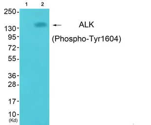 Anti-ALK (phospho Tyr1604) antibody used in Western Blot (WB). GTX16377
