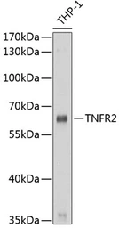 Anti-TNF Receptor II antibody used in Western Blot (WB). GTX16384