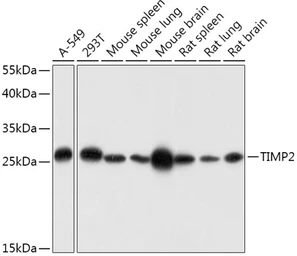 Anti-TIMP2 antibody used in Western Blot (WB). GTX16392