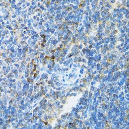 Anti-UBE2D1 antibody used in IHC (Paraffin sections) (IHC-P). GTX16400