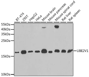Anti-UEV1A antibody used in Western Blot (WB). GTX16444