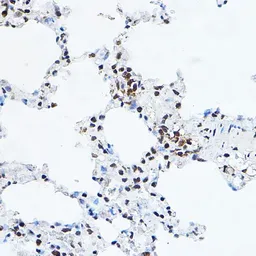Anti-GAS41 antibody used in IHC (Paraffin sections) (IHC-P). GTX16452