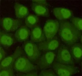 Anti-RAD23B antibody [5H1-A10-A7] used in Immunocytochemistry/ Immunofluorescence (ICC/IF). GTX16485