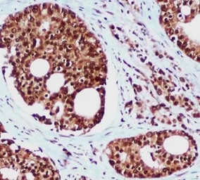 Anti-RAD23B antibody [5H1-A10-A7] used in IHC (Paraffin sections) (IHC-P). GTX16485