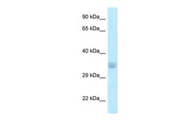 Anti-ACOT8 antibody, N-term used in Western Blot (WB). GTX16544