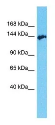 Anti-AATK antibody, C-term used in Western Blot (WB). GTX16550