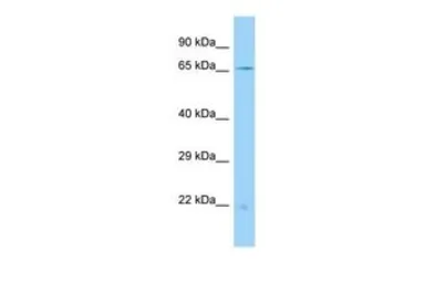 Anti-ACSM4 antibody, N-term used in Western Blot (WB). GTX16564