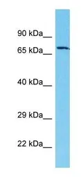 Anti-ACOX2 antibody, C-term used in Western Blot (WB). GTX16571