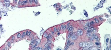 Anti-ABHD5 antibody, C-term used in IHC (Paraffin sections) (IHC-P). GTX16575
