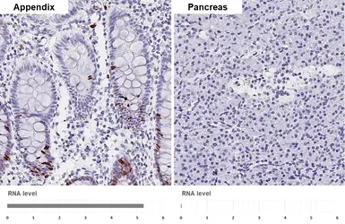 Anti-Ki67 antibody [SP6] used in IHC (Paraffin sections) (IHC-P). GTX16667