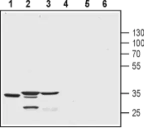 Anti-CSEN antibody used in Western Blot (WB). GTX16715