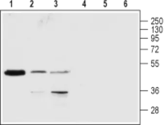 Anti-P2Y1 antibody used in Western Blot (WB). GTX16924