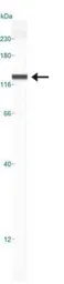 Anti-Nucleolin antibody used in Western Blot (WB). GTX16940
