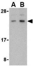 Anti-BANF1 antibody used in Western Blot (WB). GTX16986