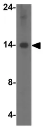 Anti-BANF1 antibody used in Western Blot (WB). GTX16987