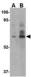 Anti-DHX58 antibody used in Western Blot (WB). GTX16994