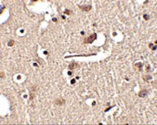 Anti-SLITRK2 antibody used in IHC (Paraffin sections) (IHC-P). GTX17000