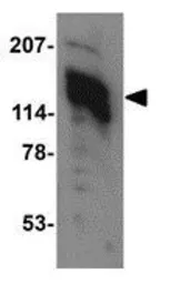 Anti-AMBRA1 antibody used in Western Blot (WB). GTX17003