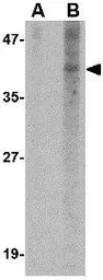 Anti-NANOS1 antibody used in Western Blot (WB). GTX17009