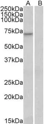 Anti-FOXO3A antibody, C-term used in Western Blot (WB). GTX17026