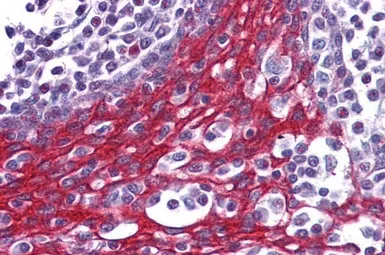 Anti-FOXO3A antibody, C-term used in IHC (Paraffin sections) (IHC-P). GTX17026