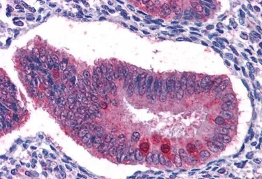Anti-FOXO3A antibody, C-term used in IHC (Paraffin sections) (IHC-P). GTX17026