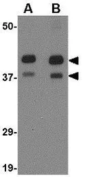 Anti-AIPL1 antibody used in Western Blot (WB). GTX17027