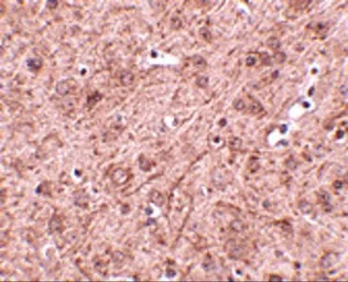 Anti-LASS6 antibody used in IHC (Paraffin sections) (IHC-P). GTX17028