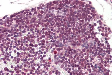 Anti-RAN antibody, N-term used in IHC (Paraffin sections) (IHC-P). GTX17033