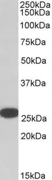 Anti-RanBP1 antibody, C-term used in Western Blot (WB). GTX17034