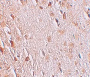 Anti-WIZ antibody used in IHC (Paraffin sections) (IHC-P). GTX17094