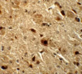 Anti-Nkx3.2 antibody used in IHC (Paraffin sections) (IHC-P). GTX17098
