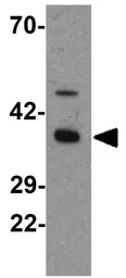 Anti-Apolipoprotein A4 antibody used in Western Blot (WB). GTX17117