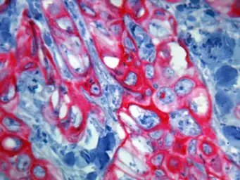 Anti-Cytokeratin 5 + 6 antibody [D5/16 B4] used in IHC (Paraffin sections) (IHC-P). GTX17133