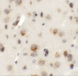 Anti-AP3B2 antibody used in IHC (Paraffin sections) (IHC-P). GTX17145