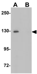Anti-Epac2 antibody used in Western Blot (WB). GTX17165