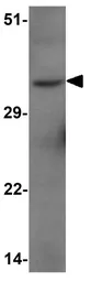 Anti-FOXH1 antibody used in Western Blot (WB). GTX17182